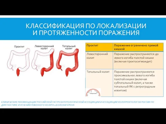 КЛАССИФИКАЦИЯ ПО ЛОКАЛИЗАЦИИ И ПРОТЯЖЕННОСТИ ПОРАЖЕНИЯ КЛИНИЧЕСКИЕ РЕКОМЕНДАЦИИ РОССИЙСКОЙ ГАСТРОЭНТЕРОЛОГИЧЕСКОЙ АССОЦИАЦИИ