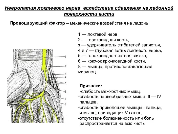 Признаки: -слабость межкостных мышц, слабость червеобразных мышц III — IV пальцев,