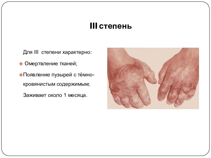 III степень Для III степени характерно: Омертвление тканей; Появление пузырей с