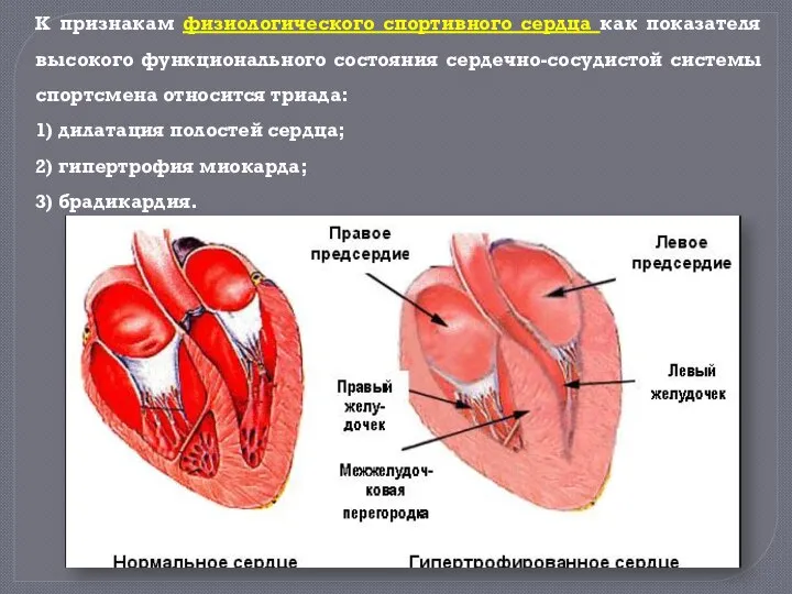 К признакам физиологического спортивного сердца как показателя высокого функционального состояния сердечно-сосудистой