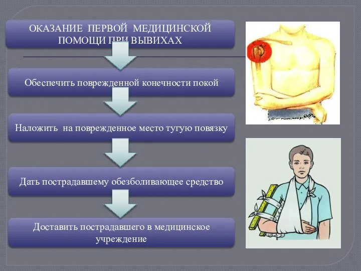 ОКАЗАНИЕ ПЕРВОЙ МЕДИЦИНСКОЙ ПОМОЩИ ПРИ ВЫВИХАХ Обеспечить поврежденной конечности покой Наложить