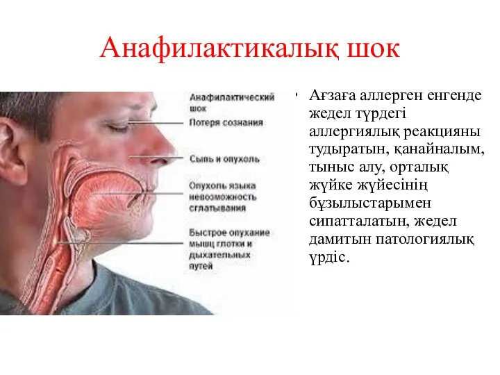 Анафилактикалық шок Ағзаға аллерген енгенде жедел түрдегі аллергиялық реакцияны тудыратын, қанайналым,