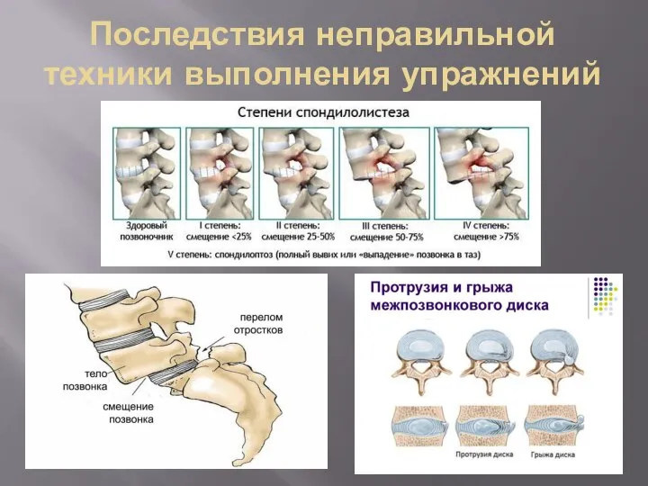 Последствия неправильной техники выполнения упражнений