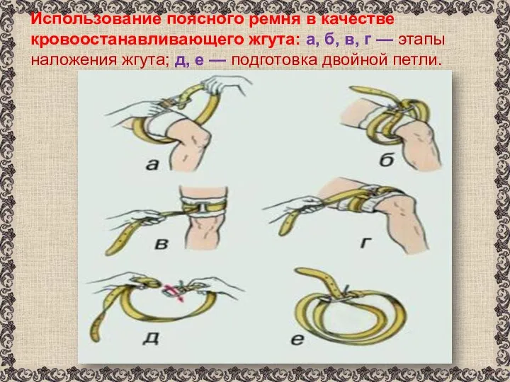 Использование поясного ремня в качестве кровоостанавливающего жгута: а, б, в, г