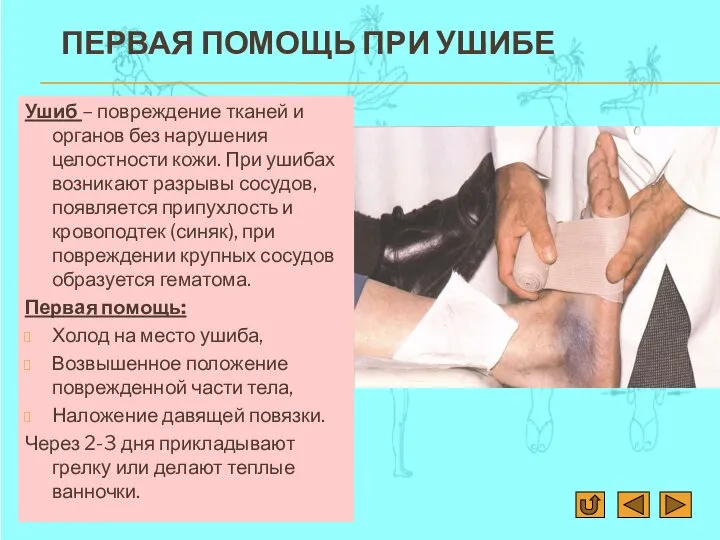 ПЕРВАЯ ПОМОЩЬ ПРИ УШИБЕ Ушиб – повреждение тканей и органов без