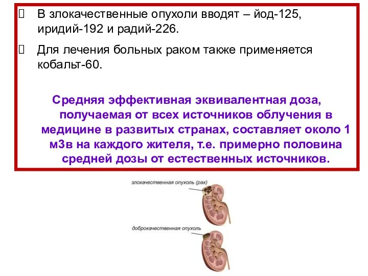 В злокачественные опухоли вводят – йод-125, иридий-192 и радий-226. Для лечения