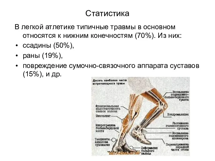 Статистика В легкой атлетике типичные травмы в основном относятся к нижним