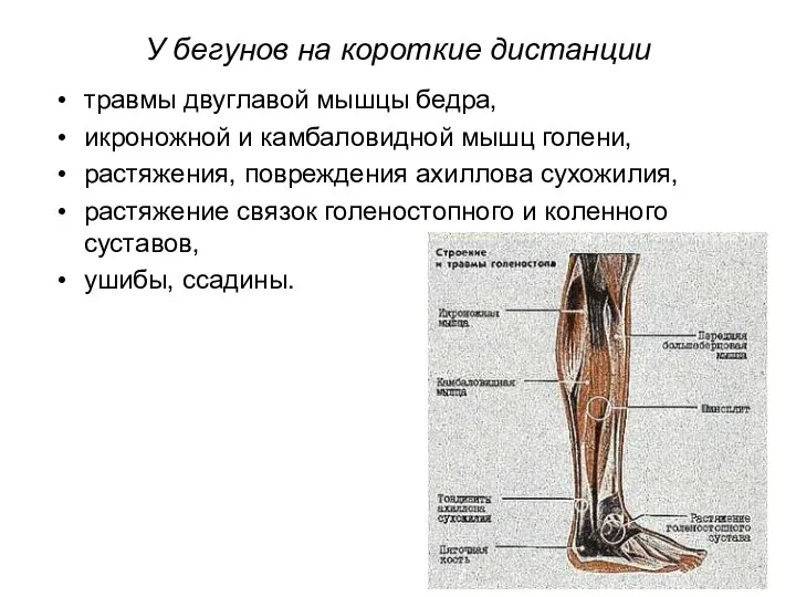 У бегунов на короткие дистанции травмы двуглавой мышцы бедра, икроножной и