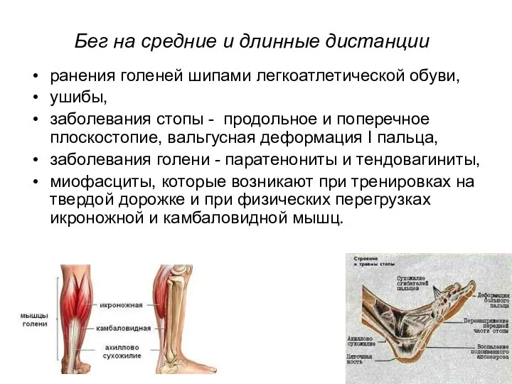 Бег на средние и длинные дистанции ранения голеней шипами легкоатлетической обуви,