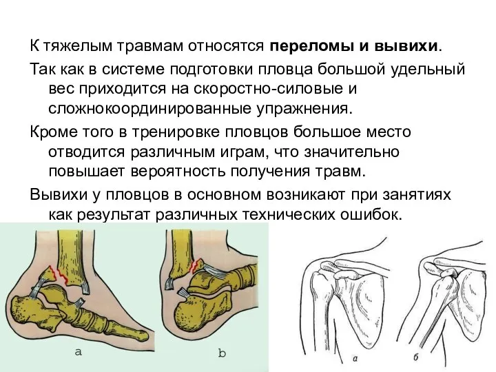 К тяжелым травмам относятся переломы и вывихи. Так как в системе