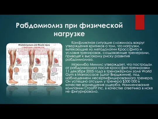 Рабдомиолиз при физической нагрузке Конфликтная ситуация сложилась вокруг утверждения критиков о