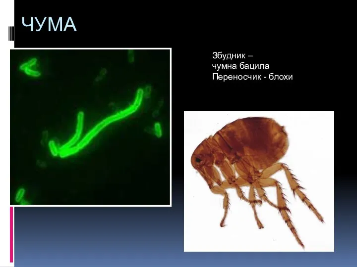 ЧУМА Збудник – чумна бацила Переносчик - блохи