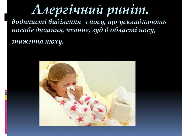 Алергічний риніт. водянисті виділення з носу, що ускладнюють носове дихання, чханне, зуд в області носу,зниження нюху.