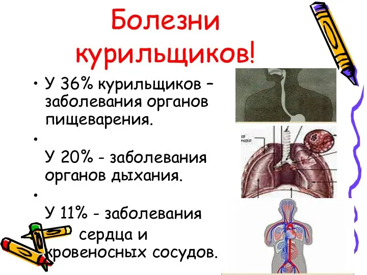 Болезни курильщиков! У 36% курильщиков – заболевания органов пищеварения. У 20%