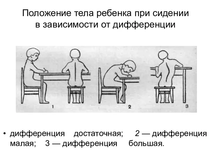 Положение тела ребенка при сидении в зависимости от дифференции дифференция достаточная;