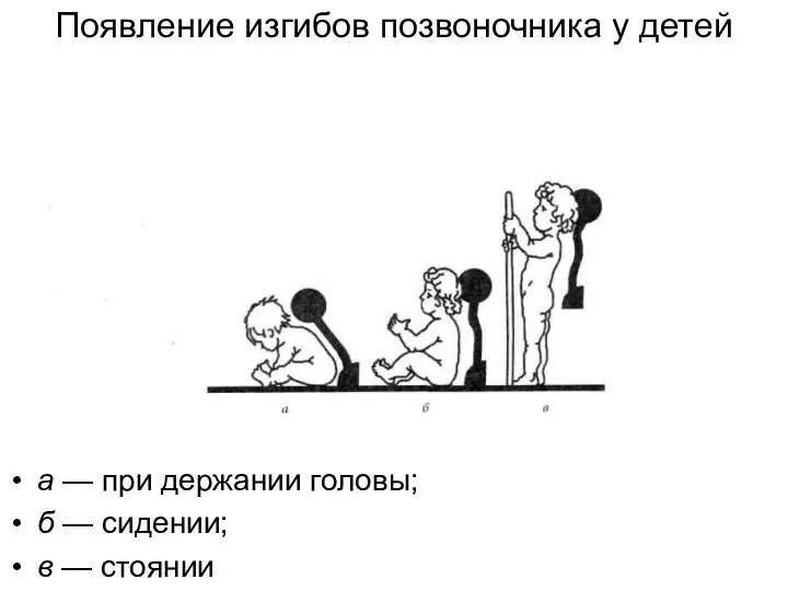 Появление изгибов позвоночника у детей а — при держании головы; б — сидении; в — стоянии