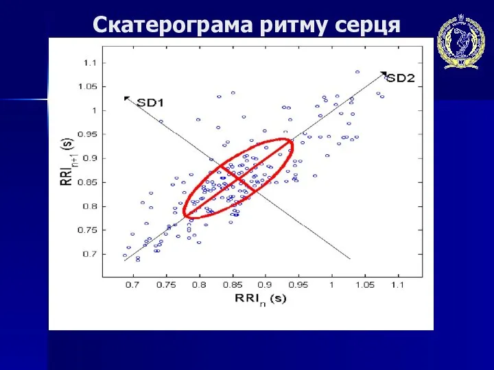 Скатерограма ритму серця