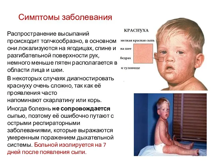 Симптомы заболевания Распространение высыпаний происходит толчкообразно, в основном они локализуются на