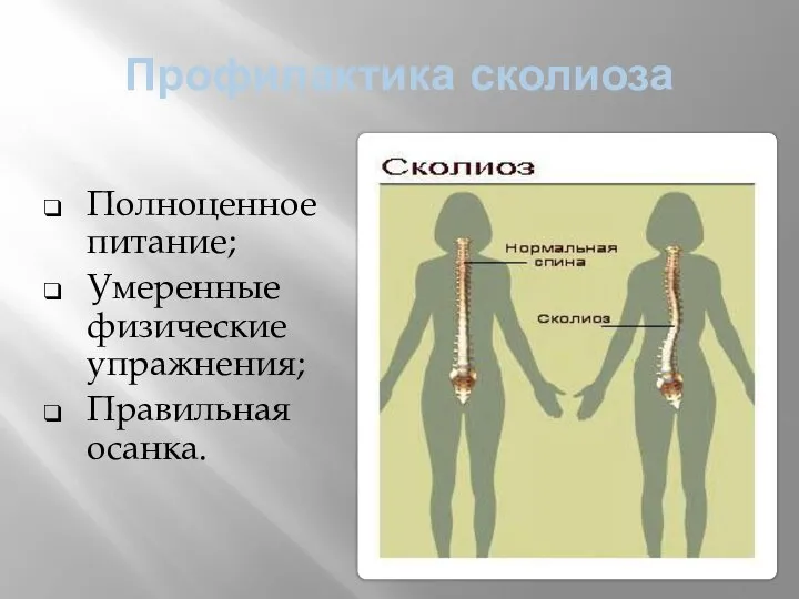 Профилактика сколиоза Полноценное питание; Умеренные физические упражнения; Правильная осанка.