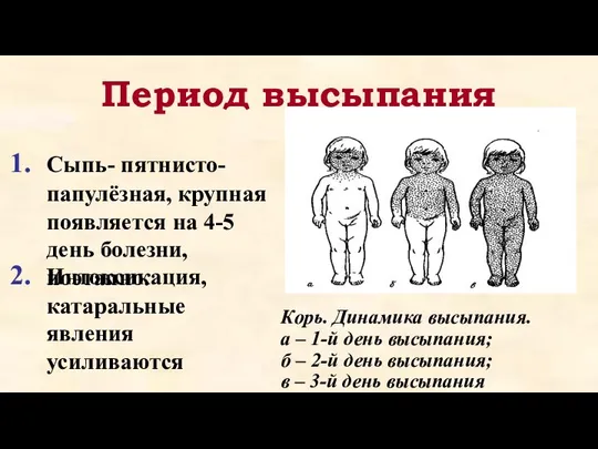 Период высыпания Сыпь- пятнисто- папулёзная, крупная появляется на 4-5 день болезни,