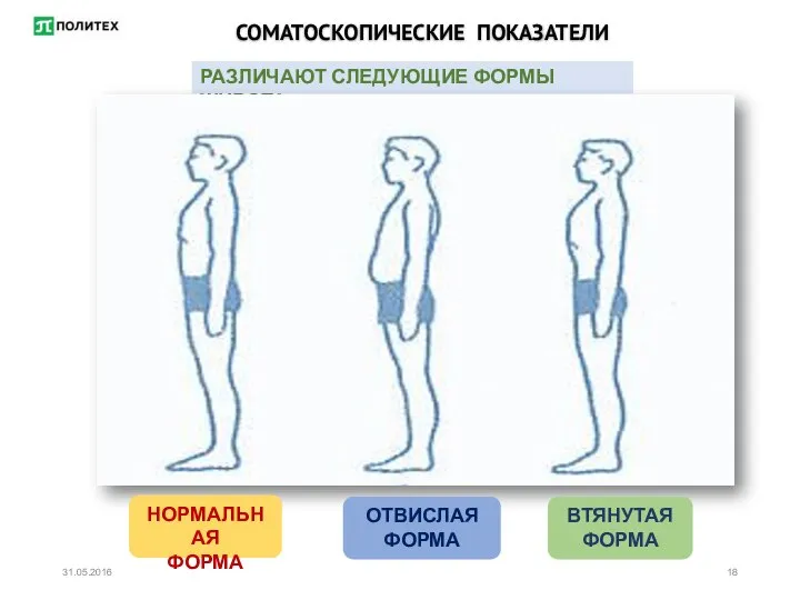 СОМАТОСКОПИЧЕСКИЕ ПОКАЗАТЕЛИ РАЗЛИЧАЮТ СЛЕДУЮЩИЕ ФОРМЫ ЖИВОТА: НОРМАЛЬНАЯ ФОРМА ОТВИСЛАЯ ФОРМА ВТЯНУТАЯ ФОРМА 31.05.2016