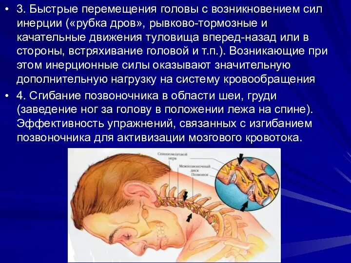 3. Быстрые перемещения головы с возникновением сил инерции («рубка дров», рывково-тормозные