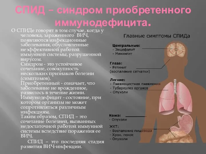 СПИД – синдром приобретенного иммунодефицита. О СПИДе говорят в том случае,