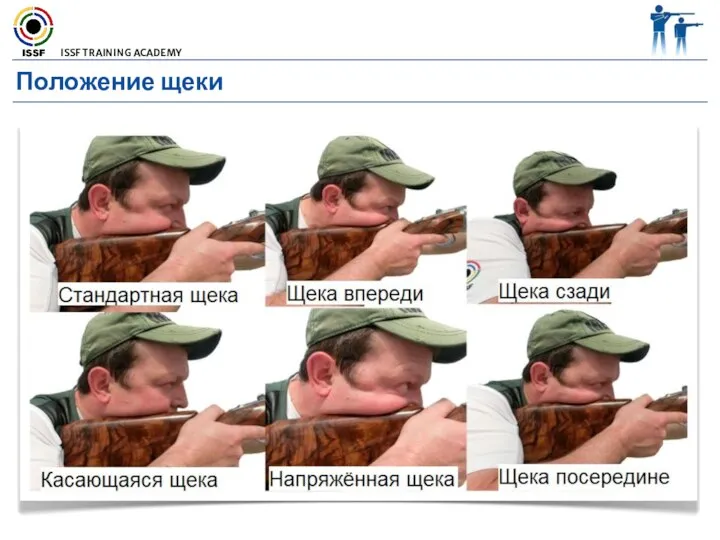 Положение щеки