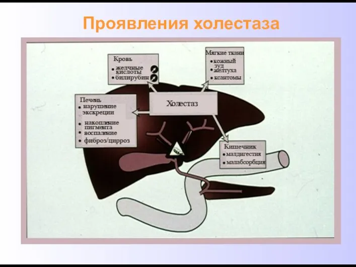 Проявления холестаза