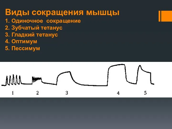 Виды сокращения мышцы 1. Одиночное сокращение 2. Зубчатый тетанус 3. Гладкий тетанус 4. Оптимум 5. Пессимум