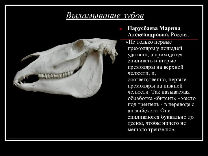 Выламывание зубов Нарусбаева Марина Александровна, Россия. «Не только первые премоляры у