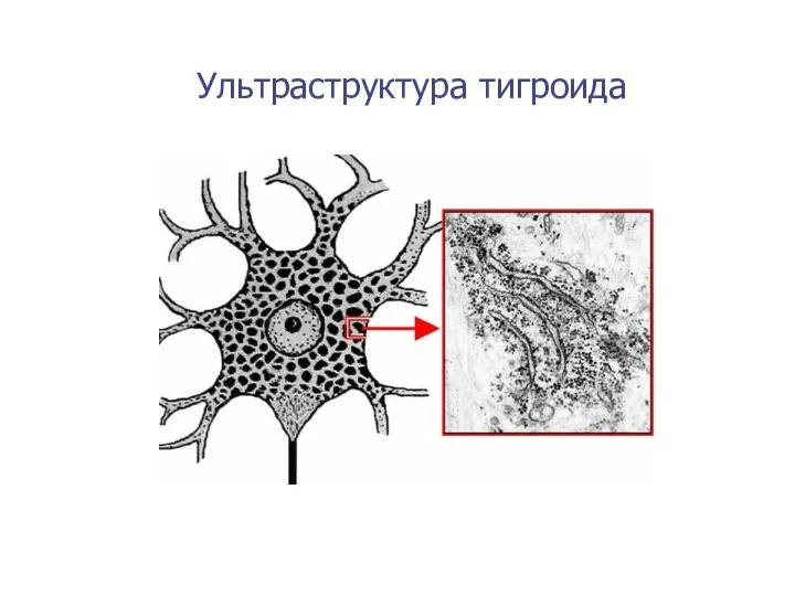 Ультраструктура тигроида