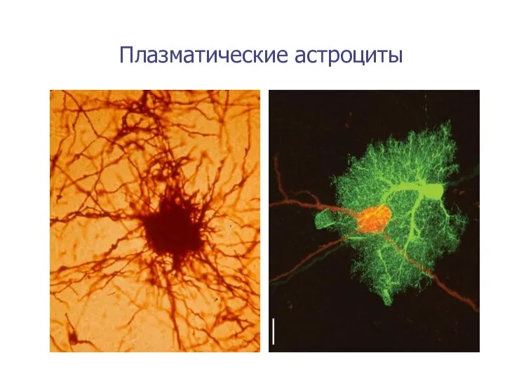 Плазматические астроциты