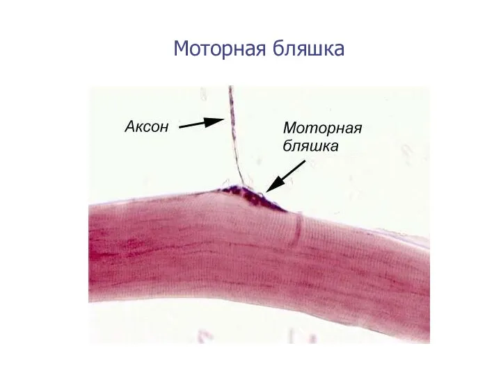 Моторная бляшка