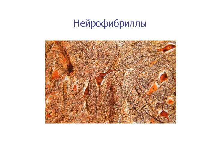 Нейрофибриллы