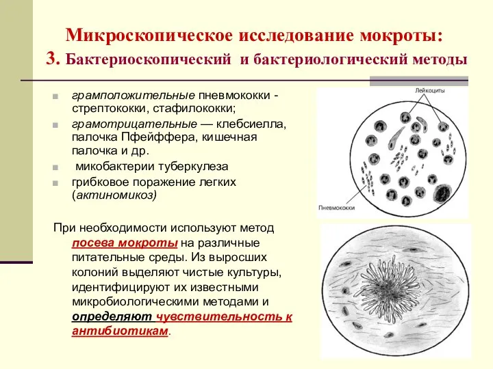 Микроскопическое исследование мокроты: 3. Бактериоскопический и бактериологический методы грамположительные пневмококки -