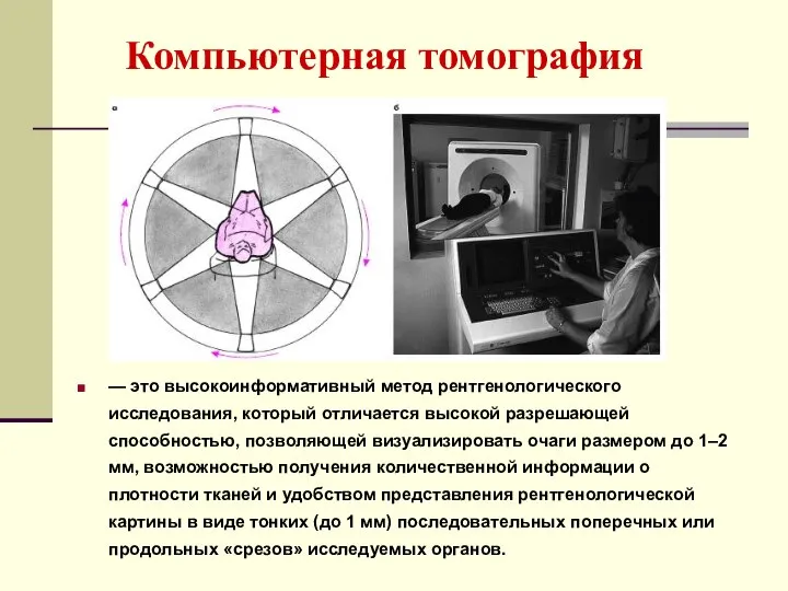 Компьютерная томография — это высокоинформативный метод рентгенологического исследования, который отличается высокой