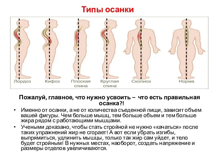 Типы осанки Пожалуй, главное, что нужно усвоить – что есть правильная