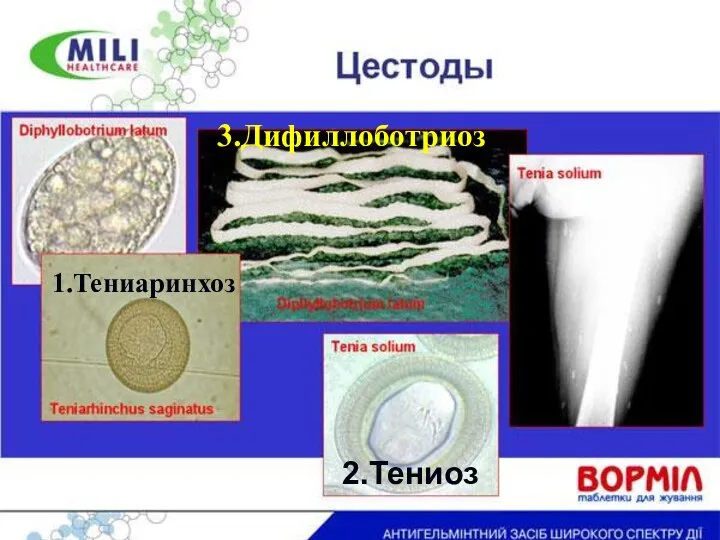 1.Тениаринхоз 2.Тениоз 3.Дифиллоботриоз