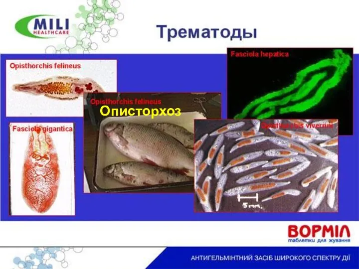 Описторхоз