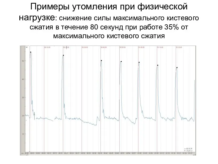 Примеры утомления при физической нагрузке: снижение силы максимального кистевого сжатия в