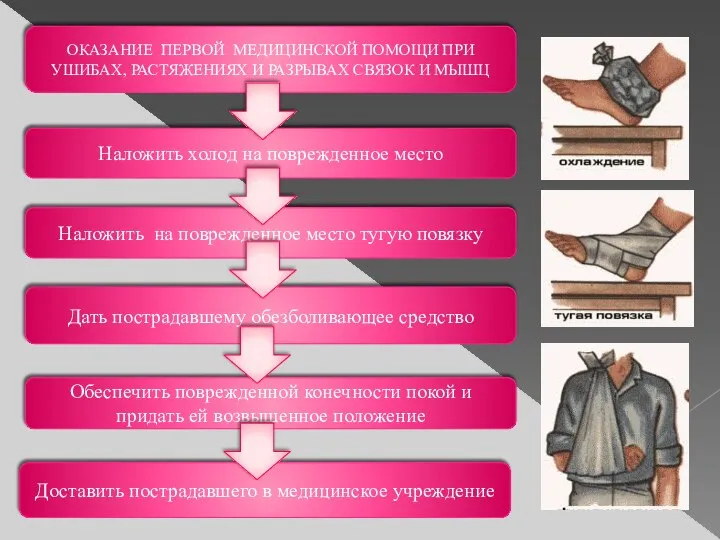 ОКАЗАНИЕ ПЕРВОЙ МЕДИЦИНСКОЙ ПОМОЩИ ПРИ УШИБАХ, РАСТЯЖЕНИЯХ И РАЗРЫВАХ СВЯЗОК И