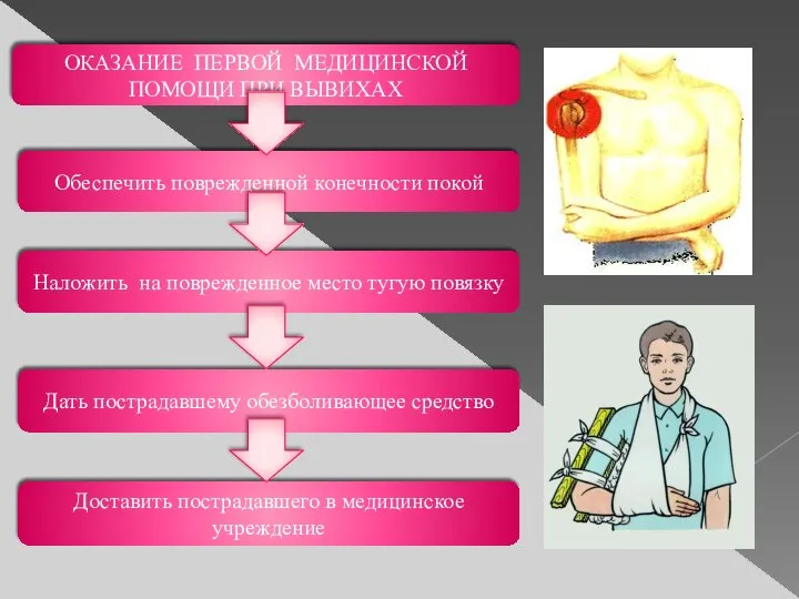 ОКАЗАНИЕ ПЕРВОЙ МЕДИЦИНСКОЙ ПОМОЩИ ПРИ ВЫВИХАХ Обеспечить поврежденной конечности покой Наложить