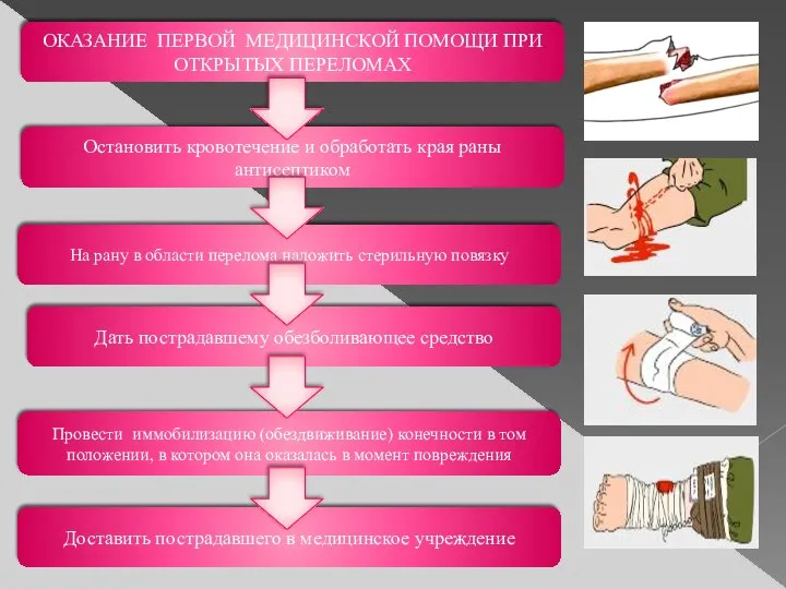 ОКАЗАНИЕ ПЕРВОЙ МЕДИЦИНСКОЙ ПОМОЩИ ПРИ ОТКРЫТЫХ ПЕРЕЛОМАХ Остановить кровотечение и обработать