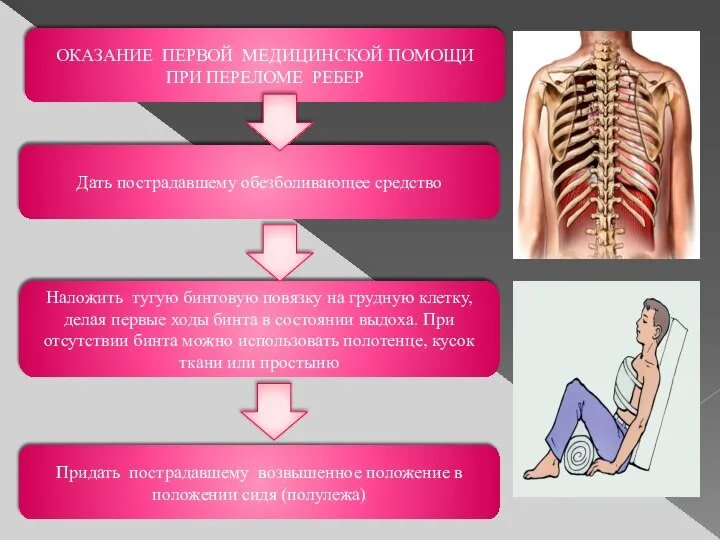 ОКАЗАНИЕ ПЕРВОЙ МЕДИЦИНСКОЙ ПОМОЩИ ПРИ ПЕРЕЛОМЕ РЕБЕР Дать пострадавшему обезболивающее средство