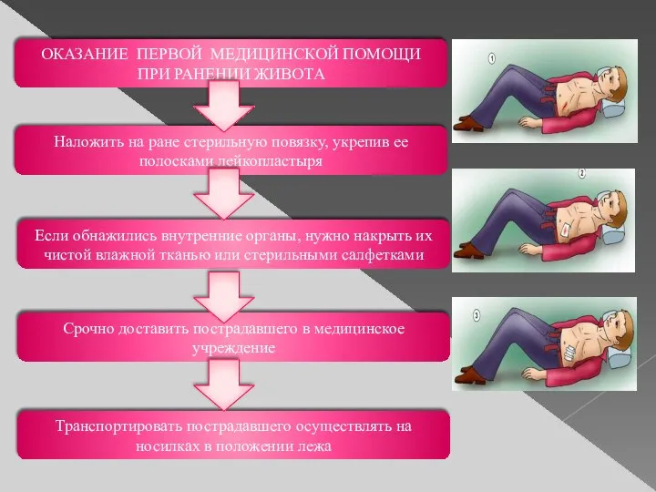 ОКАЗАНИЕ ПЕРВОЙ МЕДИЦИНСКОЙ ПОМОЩИ ПРИ РАНЕНИИ ЖИВОТА Наложить на ране стерильную