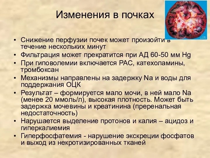 Изменения в почках Снижение перфузии почек может произойти в течение нескольких