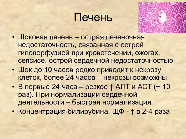 Печень Шоковая печень – острая печеночная недостаточность, связанная с острой гипоперфузией