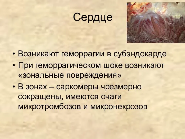 Сердце Возникают геморрагии в субэндокарде При геморрагическом шоке возникают «зональные повреждения»