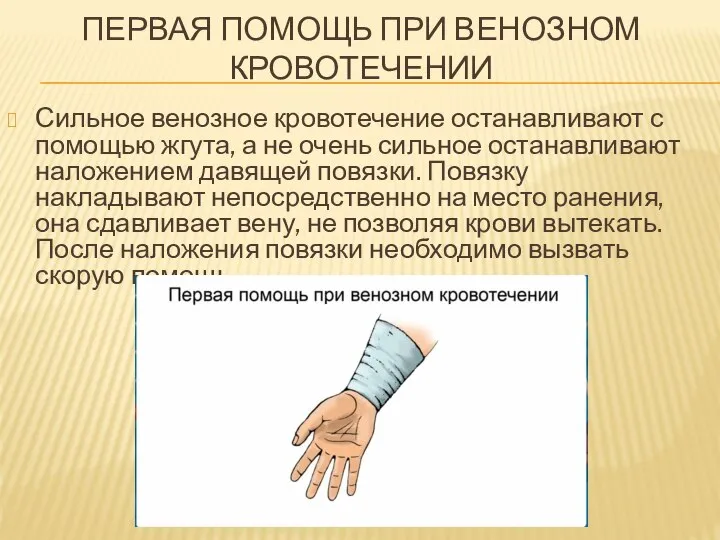 ПЕРВАЯ ПОМОЩЬ ПРИ ВЕНОЗНОМ КРОВОТЕЧЕНИИ Сильное венозное кровотечение останавливают с помощью